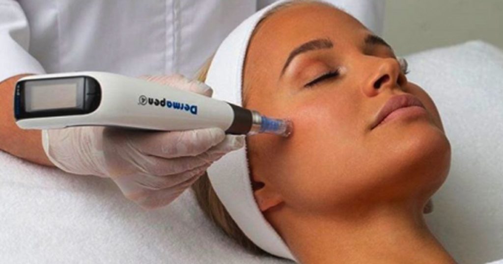 DERMAPEN 3 (Microneedling) - Beyond Basics Medical Spa